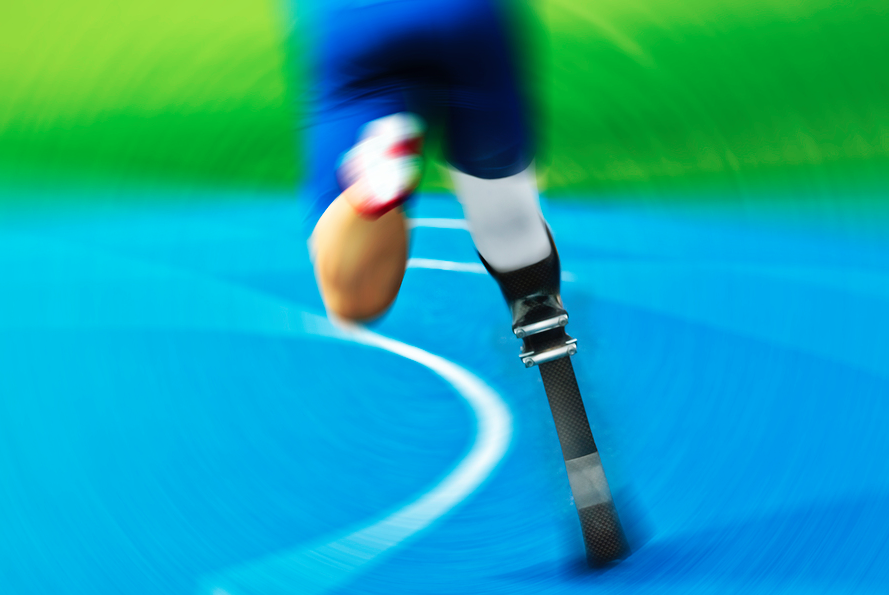 Prosthetic Gait Deviations